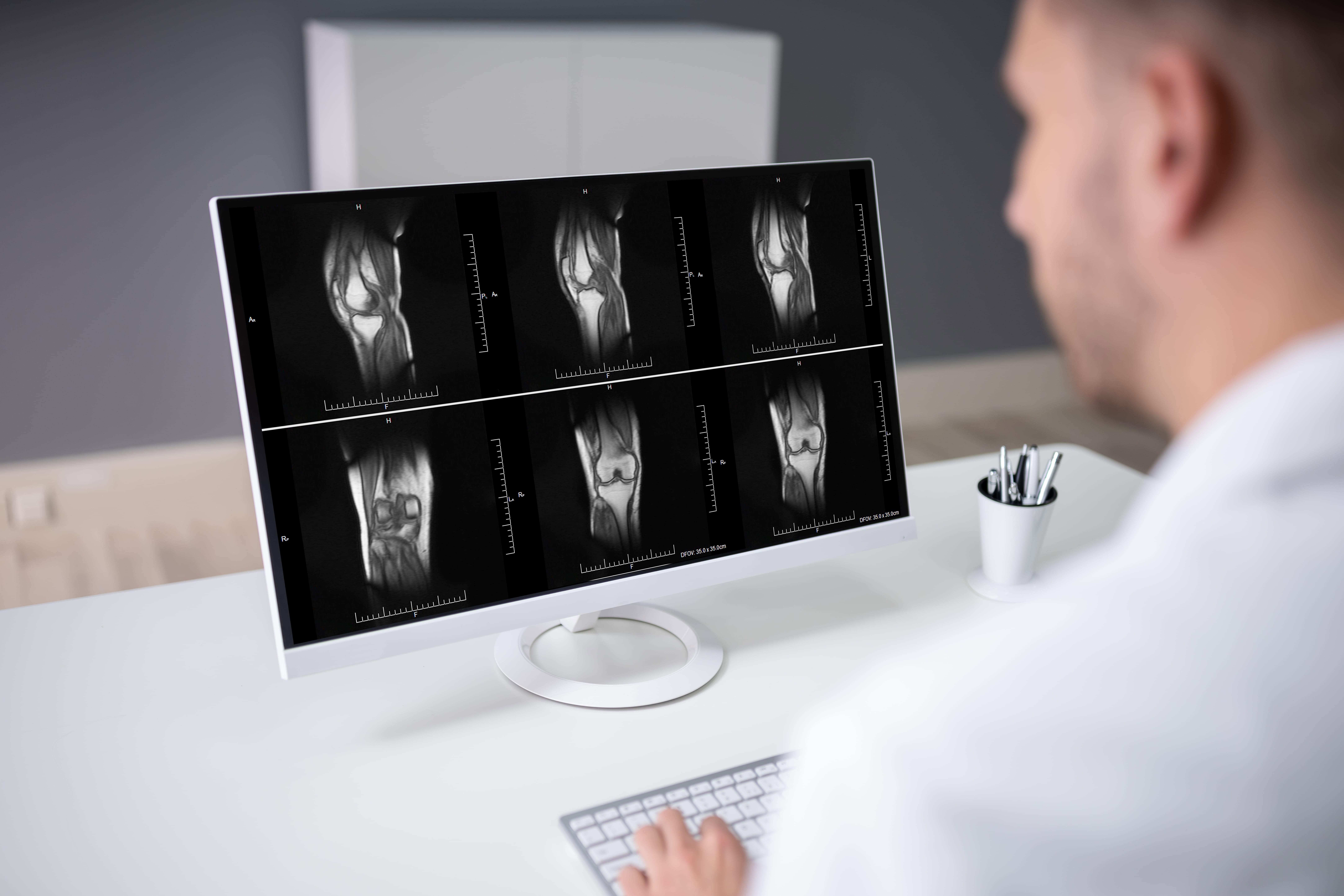 MRI Being looked at
