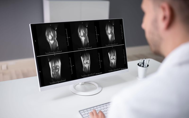 MRI Being looked at